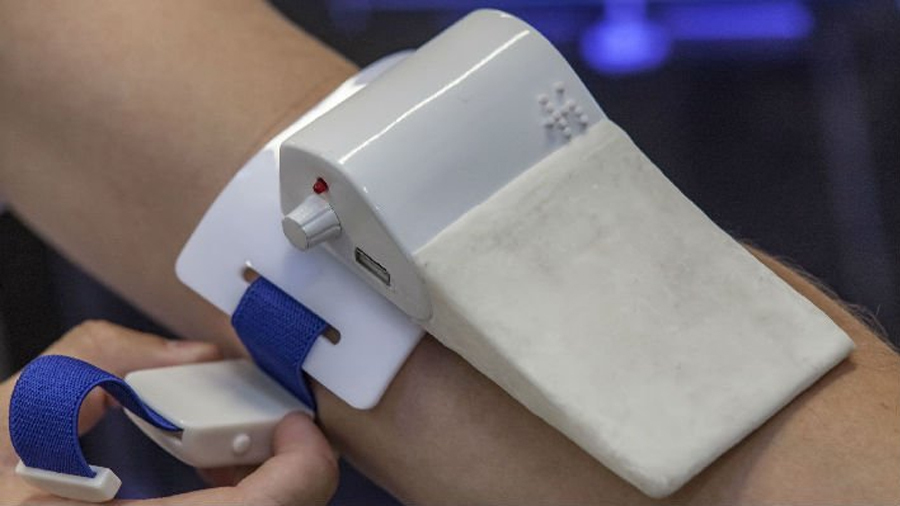 No más moretones en el brazo: Dispositivo electrónico permite sacar sangre sin dejar rastro