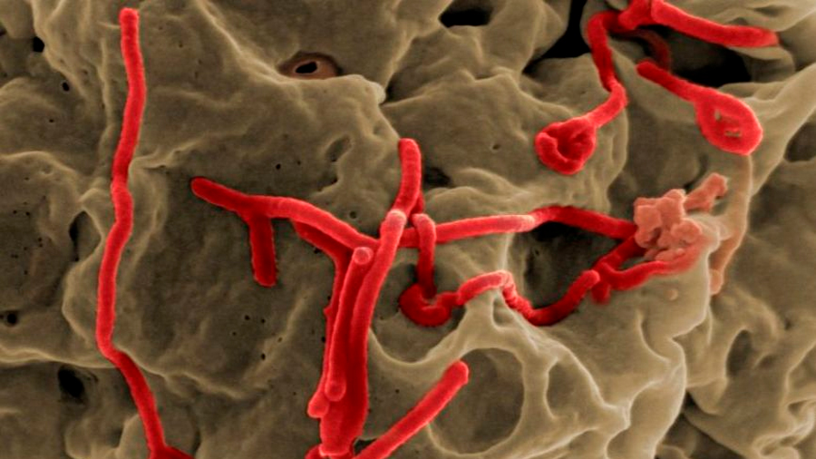 Hallado un compuesto químico que inhibe la replicación del virus del Ébola