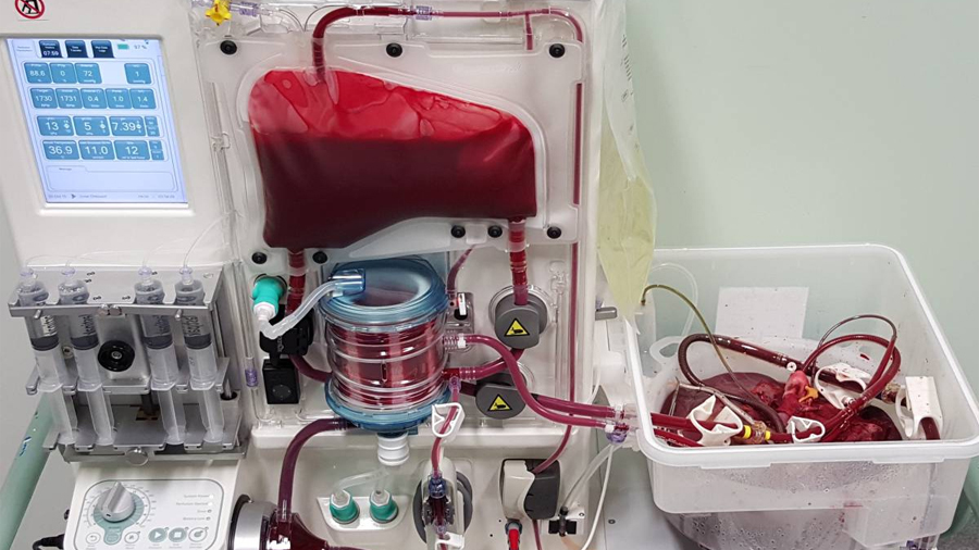 Inventan científicos un ‘respirador artificial’ para órganos que promete revolucionar los trasplantes