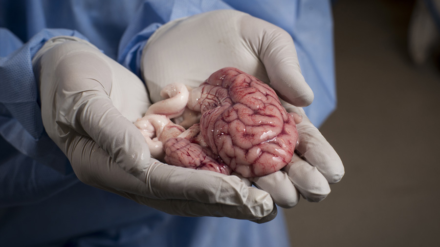 Científicos logran mantener con vida el cerebro de un cerdo sin necesidad del cuerpo