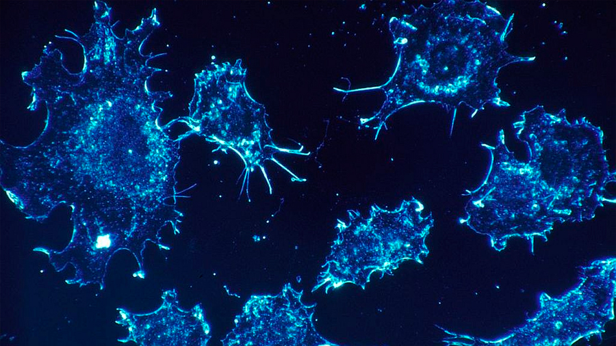 Científicos israelíes descubren tratamiento que convierte las células cancerígenas en normales