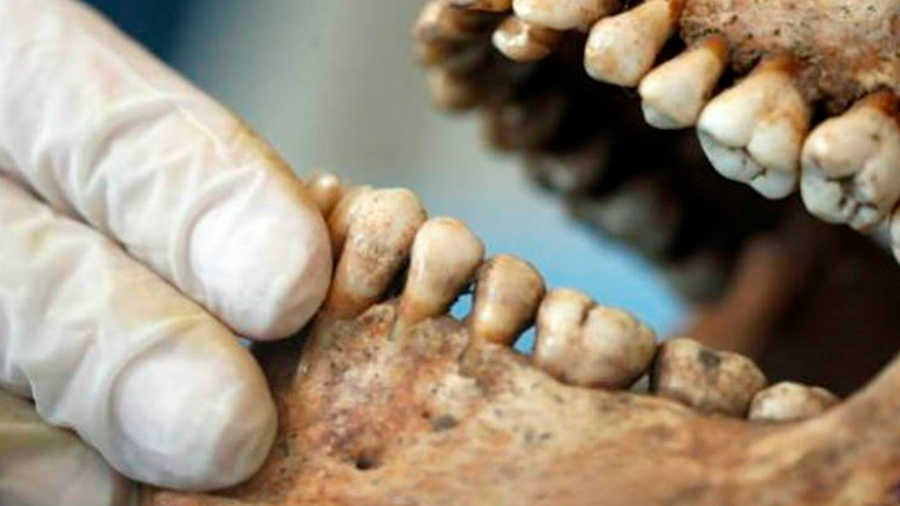 Testigos dentales: los materiales de la odontología forense