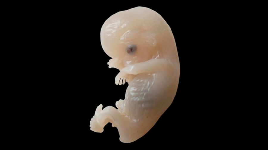 Las primeras decisiones que configuran al embrión humano; el paso a paso, célula a célula