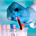Descubren análisis de sangre capaz de detectar 10 tipos de cáncer años antes de que aparezcan