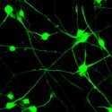 Un tratamiento experimental logra crear neuronas por primera vez