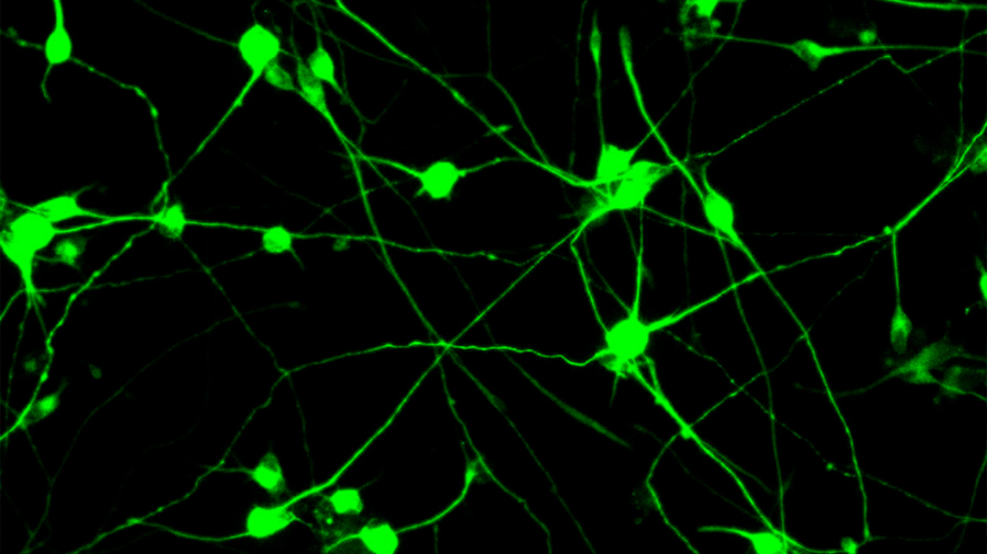Un tratamiento experimental logra crear neuronas por primera vez