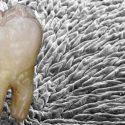 Desarrollan material que regenera el esmalte dental