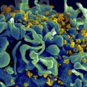 Descubren un 'super' receptor en un tipo de células que ayuda a matar las infectadas por el VIH