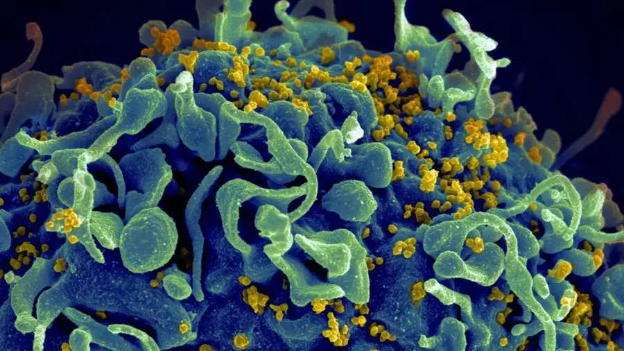 Descubren un 'super' receptor en un tipo de células que ayuda a matar las infectadas por el VIH