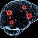 Una nueva terapia alarga la vida de pacientes con metástasis cerebral