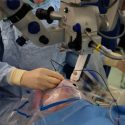 Robot realizó operaciones oculares por primera vez y su éxito fue del 100%