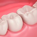 Un método crea materiales que regeneran el esmalte dental o el hueso