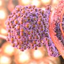 Científicos generan algoritmo que rastrea la diseminación de células cancerosas por el cuerpo