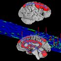 Molécula propia de la vigilia se halla en abundantes cantidades en el cerebro de los heroinómanos