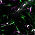 Logran y optimizan conversión directa de células no neuronales en células nerviosas