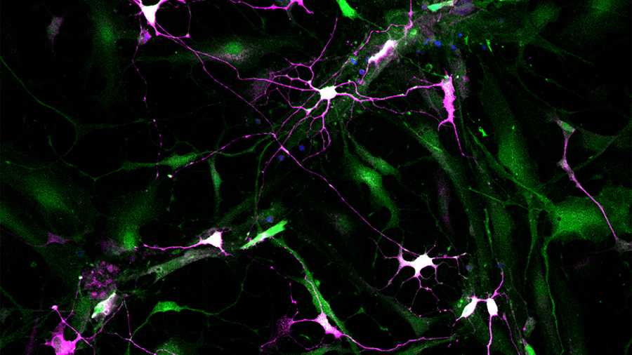 Logran y optimizan conversión directa de células no neuronales en células nerviosas