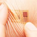 Desarrollan parche electrónico para curar heridas crónicas causadas por la diabetes
