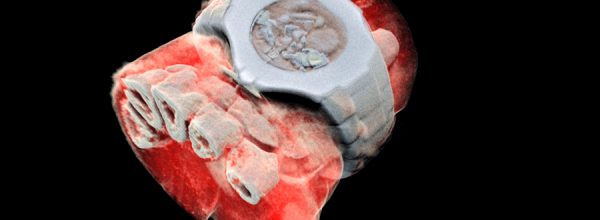 Tecnología de partículas revela las primeras imágenes 3D de rayos X en color