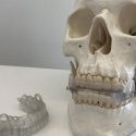 Crean investigadores españoles dispositivo bucal que previene apnea del sueño y ronquidos [VIDEO]