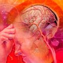 Identifican el tipo de actividad cerebral que da origen a la migraña