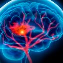 Descubren cómo un tipo de leucemia consigue llegar al cerebro