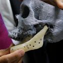 Investigador del IPN realiza prótesis de mandíbula única a nivel mundial