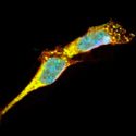 Nuevos hallazgos de una proteína que propicia 3% de los casos de Parkinson