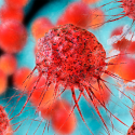 Descubren una defensa celular contra la expansión del cáncer de mama
