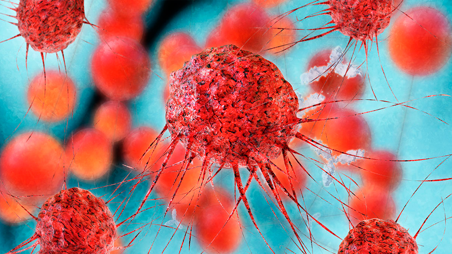 Descubren una defensa celular contra la expansión del cáncer de mama