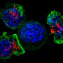 Científicos australianos crearon fármaco que 'duerme' para siempre a células cancerosas