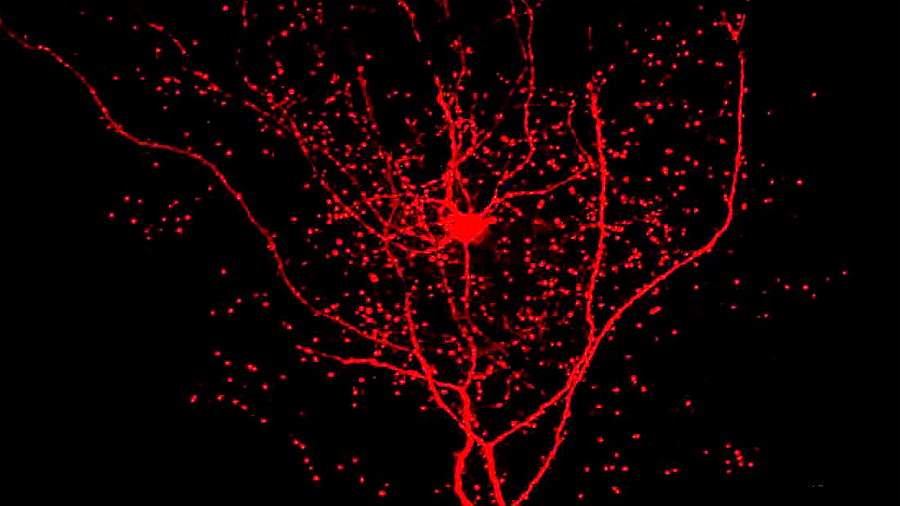 Descubren nuevo tipo de neuronas que podrían ser lo que nos diferencia de los animales
