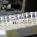 Consiguen una desaceleración "sin precedentes" en la esclerosis múltiple progresiva