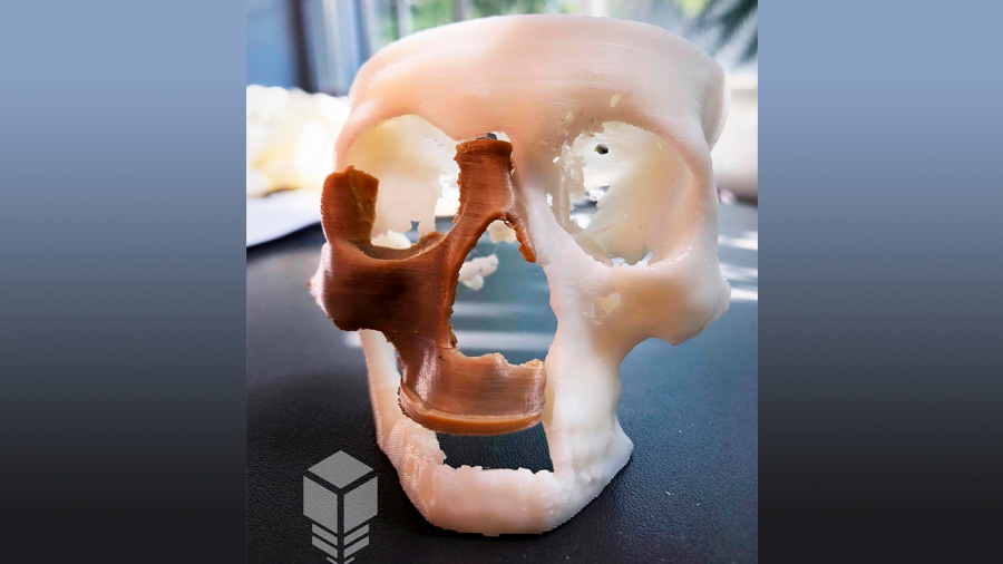 Científicos mexicanos crean método que imprime en 3D los implantes oseos