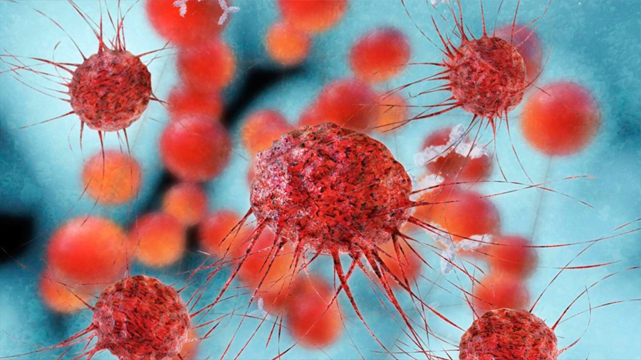 Las células asesinas naturales a menudo la clave para la inmunoterapia del cáncer