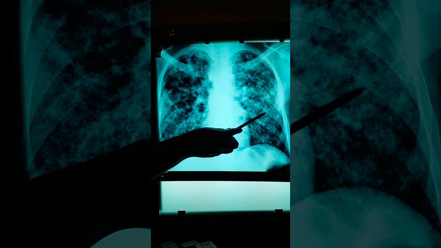 En qué casos están contraindicadas las radiografías