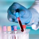 Un análisis de sangre determinará calidad de óvulos de mujeres antes de un tratamiento de fertilidad
