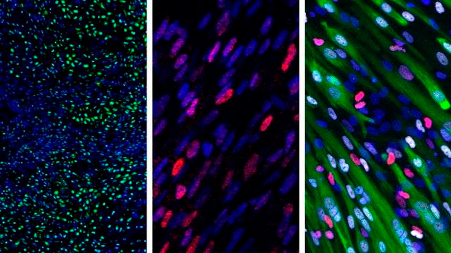 Investigadores identifican las células madre esqueléticas humanas