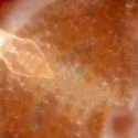 Diseñan robot capaz de residir dentro del cuerpo humano y ejercer de centinela de la salud