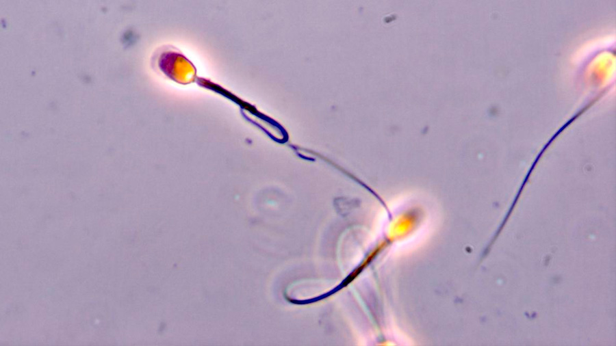 Desvelan mecanismo de espermatozoides de adquirir capacidad fértil, de la que carecen al ser eyaculados