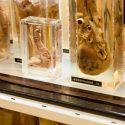 Museo de la Patología en Londres abre sus puertas por primera vez: un extraño muestrario de cuerpos enfermos