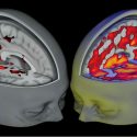 Descubren los efectos del LSD en el cerebro gracias al modelado computacional