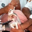 Una tortuga sobrevive tras extraerle una cuchara de plástico incrustada en su garganta
