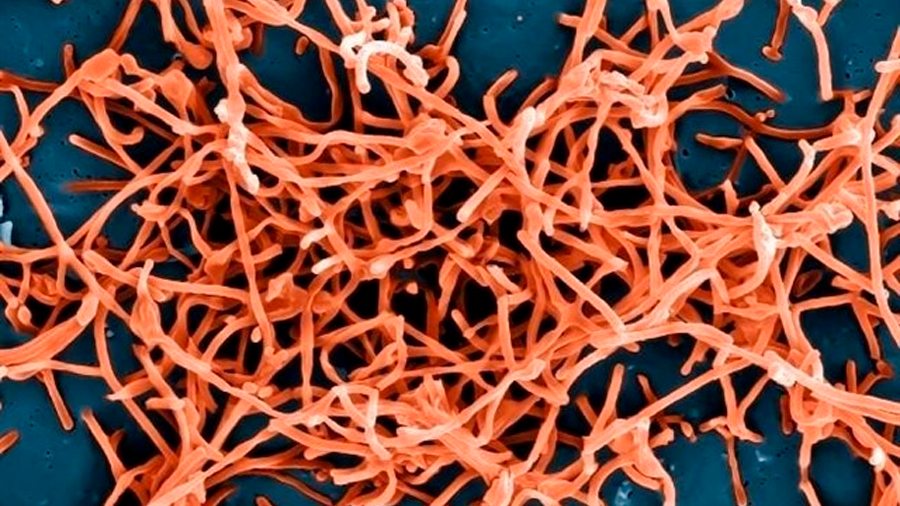 Investigadores obtienen una imagen más clara de la proteína del virus del Ébola