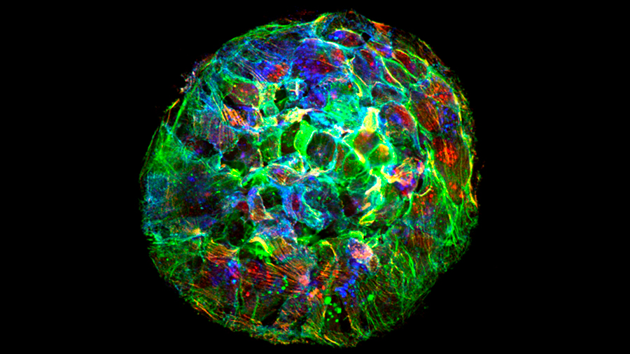 La expansión de células tumorales desafía la física actual