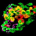 Identifican células que cambian su función inicial para combatir la diabetes