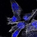 Descubren un talón de Aquiles de las células del cáncer de páncreas