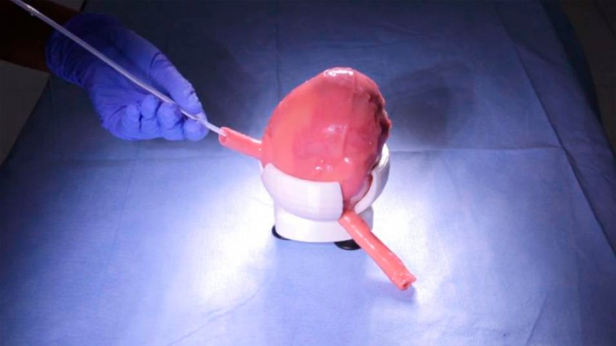 Impresión en 3D, la tecnología que fabrica órganos humanos y revoluciona las cirugías