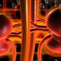 Insuficiencia renal crónica en Tierra Blanca, la tormenta perfecta: causas y soluciones