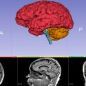 Joven científico mexicano es reconocido como talento al orbe en inteligencia artificial para el procesamiento de imágenes médicas