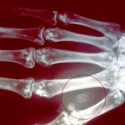 Cómo funcionan los microchips que se implantan bajo la piel y permiten pagar sin efectivo ni tarjeta